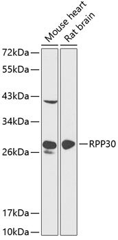 RPP30 Polyclonal Antibody[2771