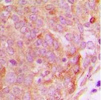 PP15 Antibody[47842]