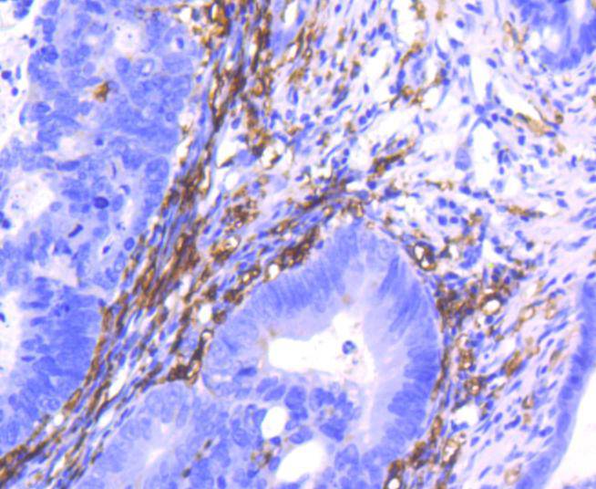 CD14 Rabbit mAb[49003]