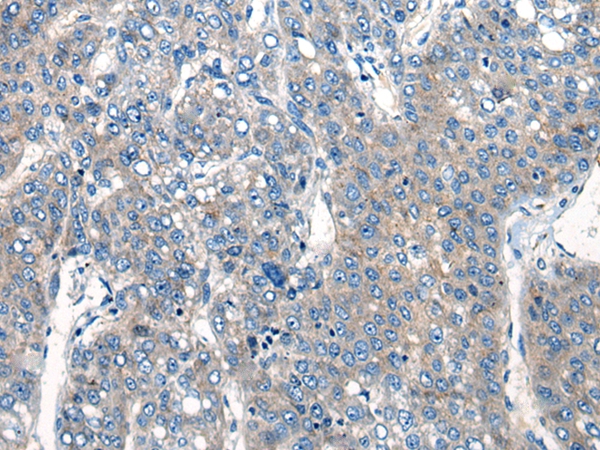 CLPX Antibody[46518]