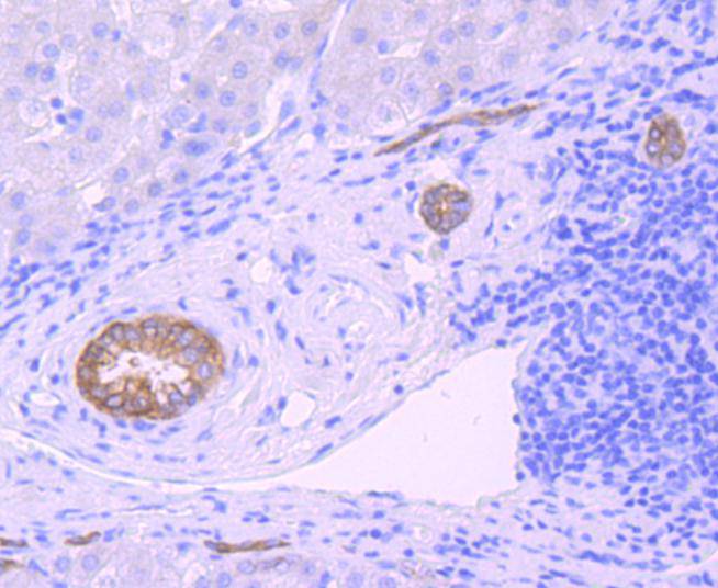 Midkine Rabbit mAb[49378]