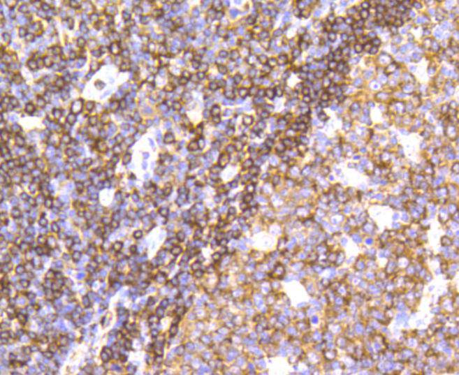 SHP1 Rabbit mAb[48636]