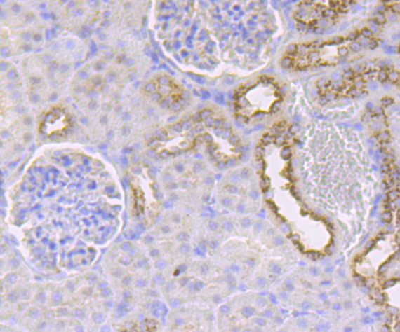 IMPDH2 Rabbit mAb[49979]