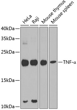 TNF-α Polyclonal Antibody[2908