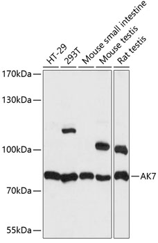 AK7 Polyclonal Antibody[28641]