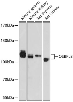 OSBPL8 Polyclonal Antibody[301