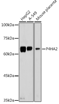 P4HA2 Polyclonal Antibody[3053