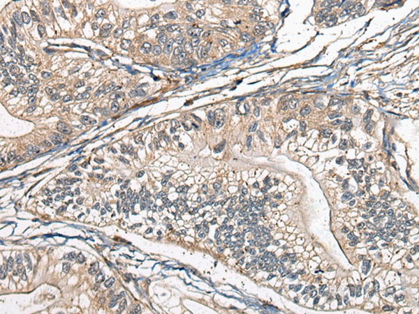 ATG2A Antibody[46319]