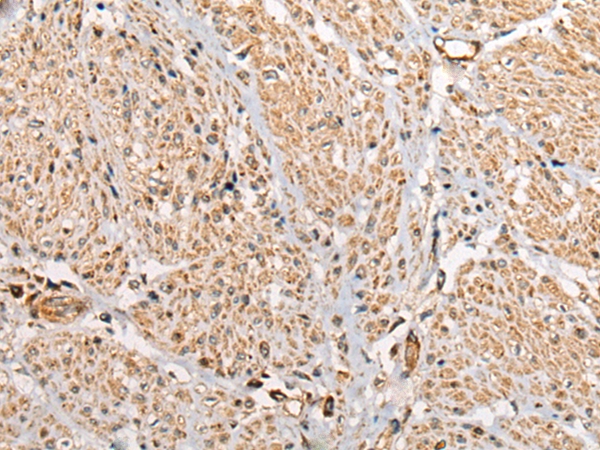 CNTLN Antibody[46526]