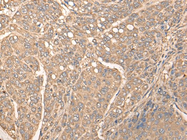 BBS1 Antibody[46335]