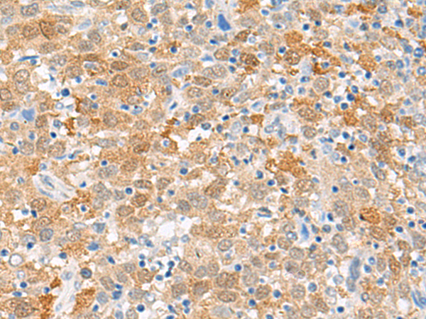 FANCB Antibody[47759]