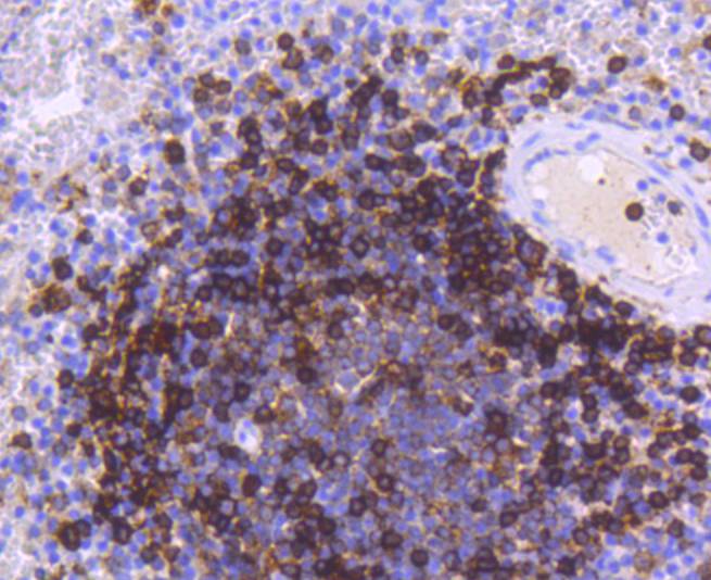 HLA-DR Rabbit mAb[48982]