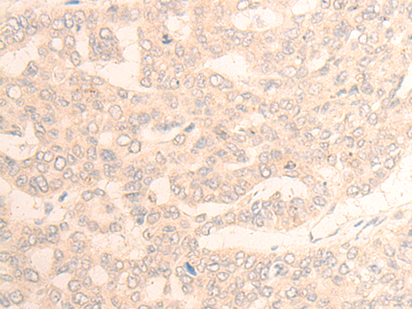 DAGLB Antibody[47015]