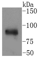 IKK alpha Rabbit mAb[49025]