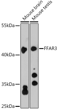 FFAR3 Polyclonal Antibody[2773