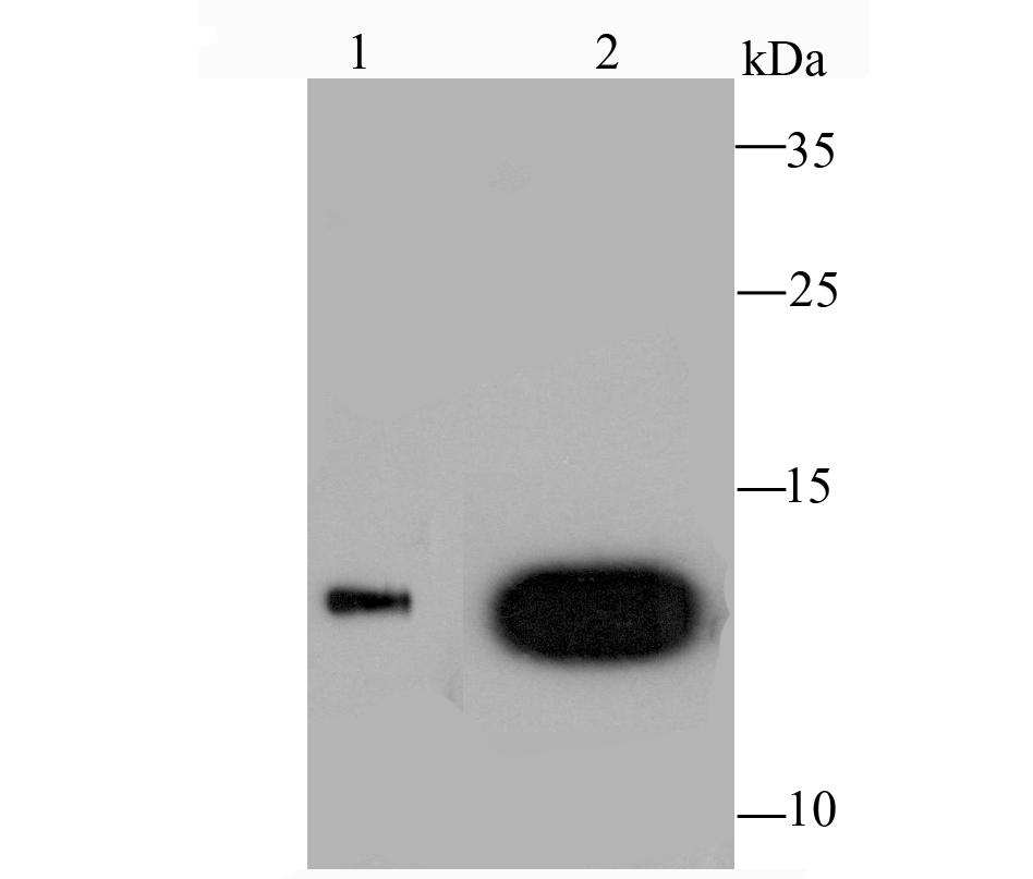 Galectin 1 Rabbit mAb[49673]