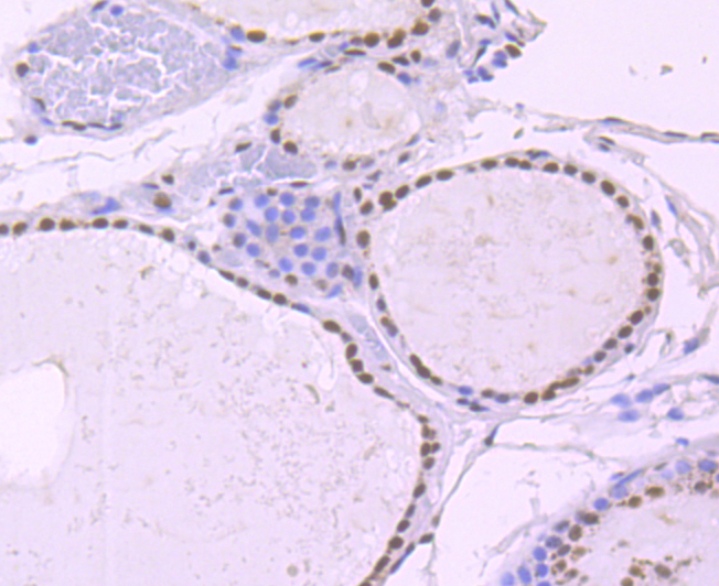 NRF1 Rabbit mAb[49676]