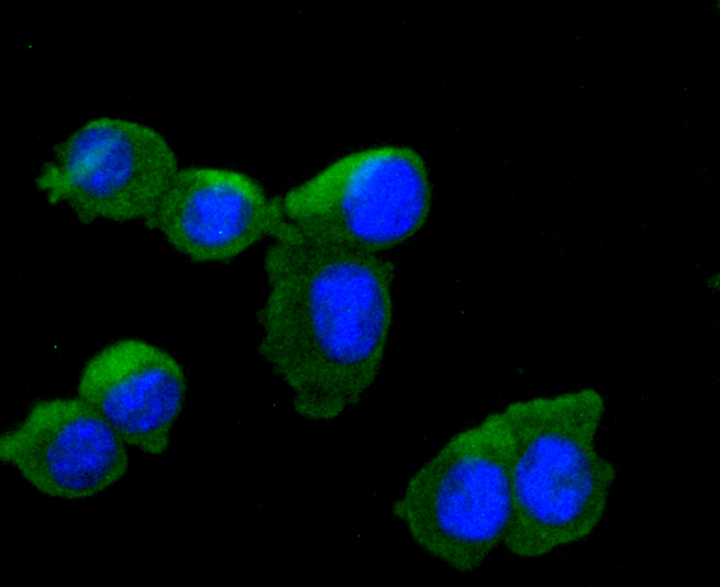 Tyrosine Hydroxylase Rabbit mA