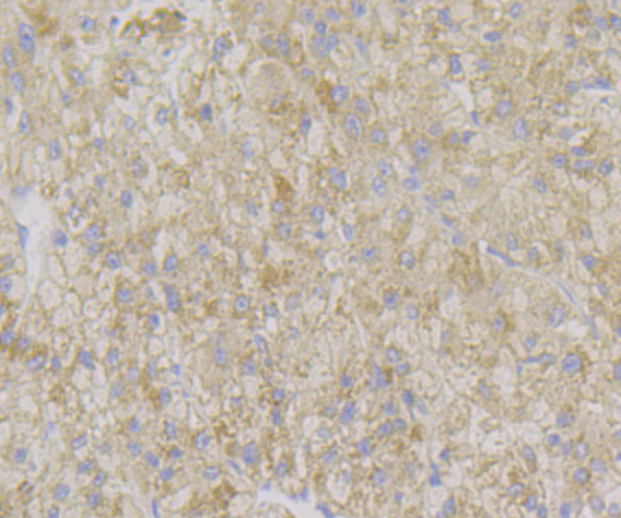 ADAMTS13 Rabbit mAb[49953]
