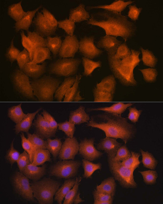 RSPO1 Polyclonal Antibody[3149