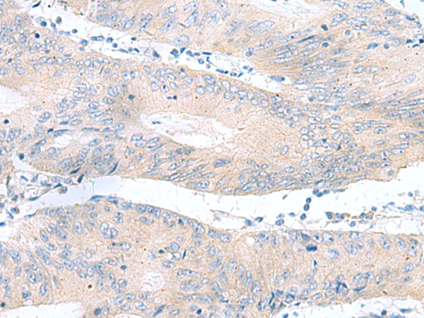 RPS16 Antibody[47438]