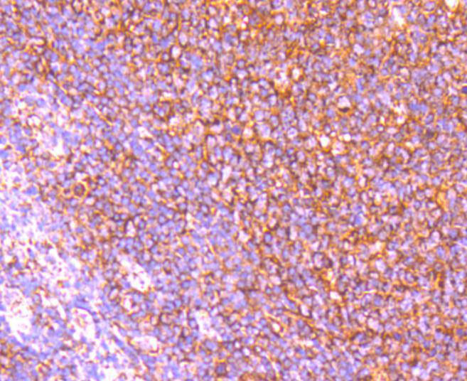 Apaf-1 Rabbit mAb[48769]