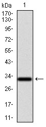 GCNF Antibody[48479]