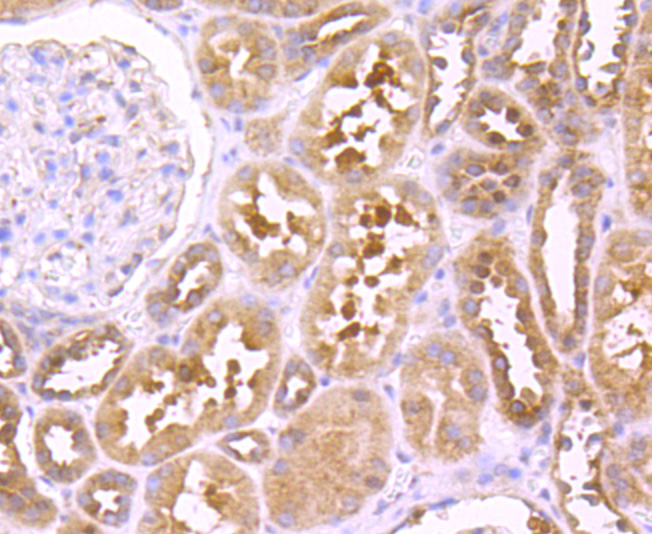 TNF Receptor II Rabbit mAb[494