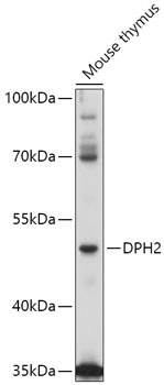 DPH2 Polyclonal Antibody[30046