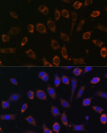 TCIRG1 Polyclonal Antibody[289