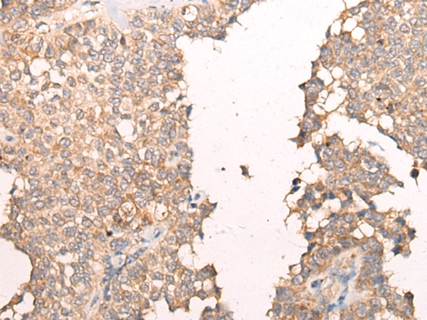 ALDH7A1 Antibody[46308]