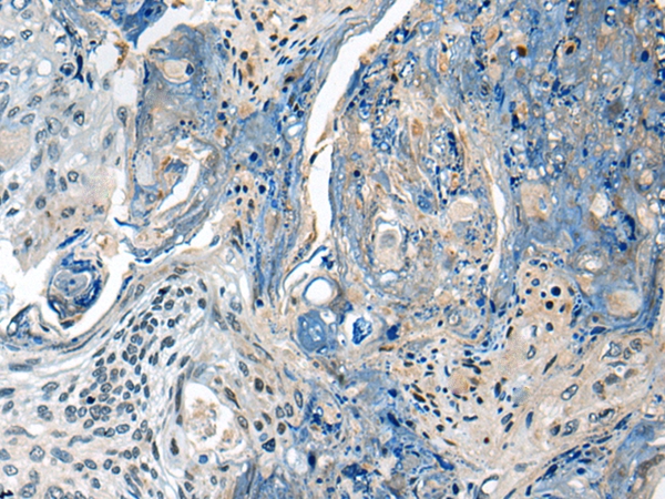 CCM2 Antibody[46424]