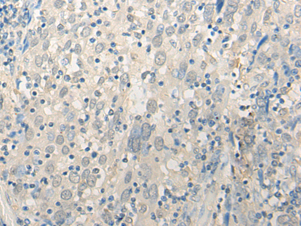 DDX23 Antibody[47038]