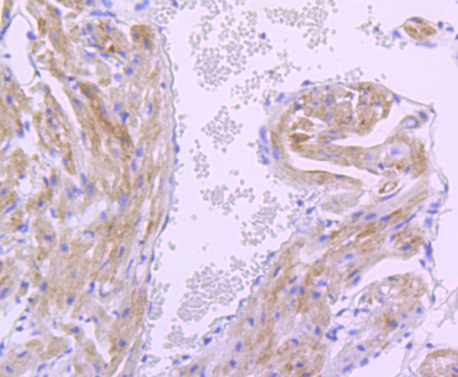 PDK1 Rabbit mAb[49573]