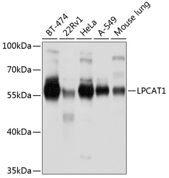 LPCAT1 Polyclonal Antibody[306