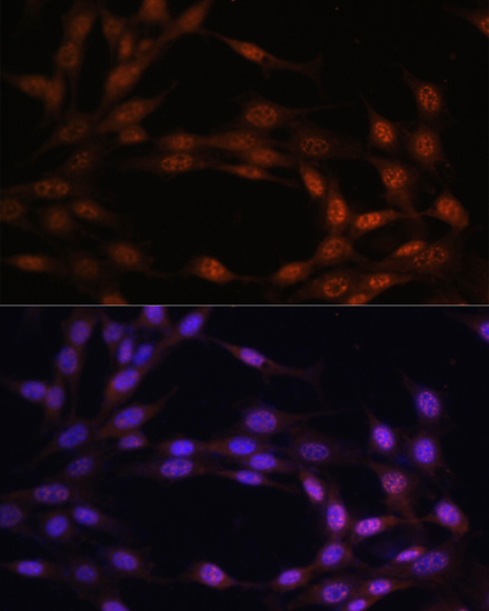 c-Jun Polyclonal Antibody[2908