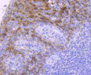 14-3-3 sigma Rabbit mAb[49152]