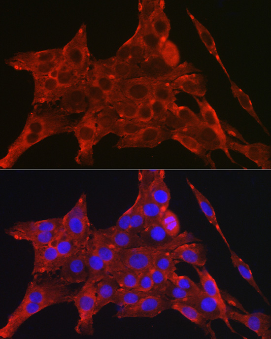 DAPK2 Polyclonal Antibody[3146