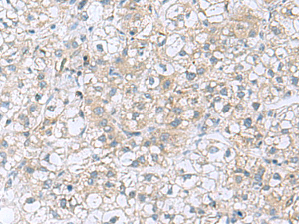 TRO antibody[31871]