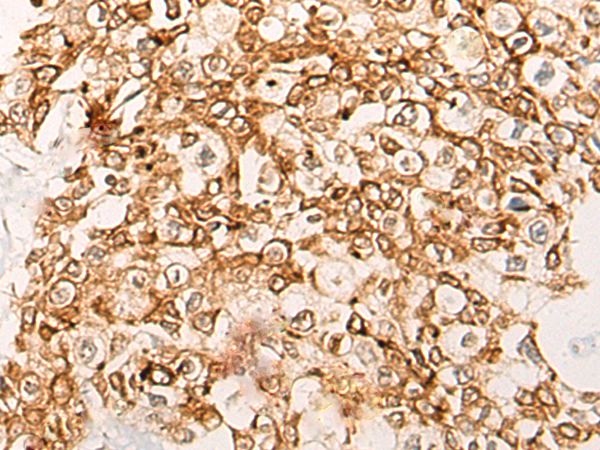 CWF19L1 Antibody[46996]