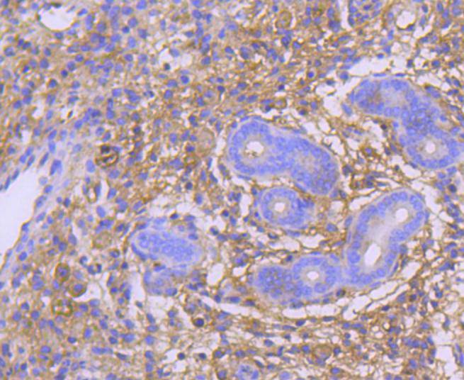 GART Rabbit mAb[48984]