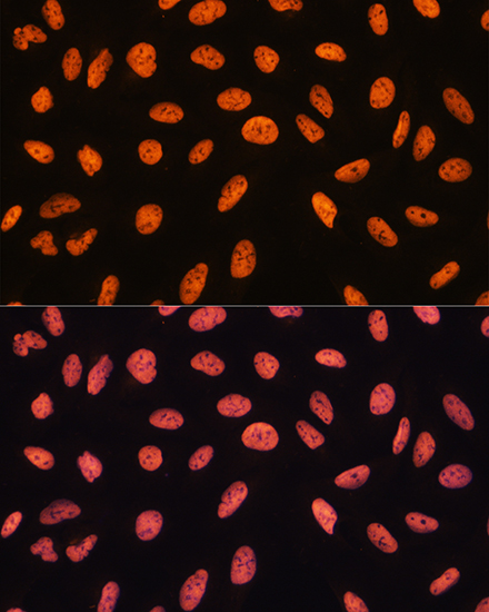CHD4 Polyclonal Antibody[29086