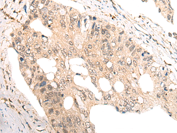 COMMD1 Antibody[46969]