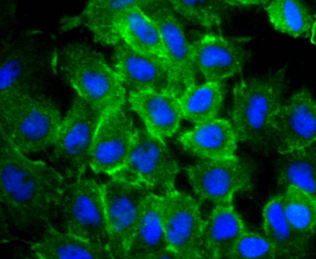 Actin Rabbit mAb[49294]