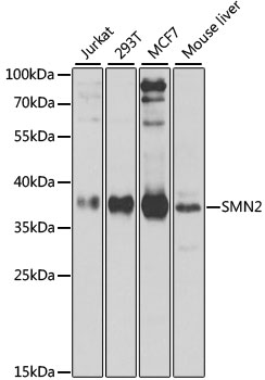 SMN2 Polyclonal Antibody[27710