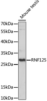 RNF125 Polyclonal Antibody[288
