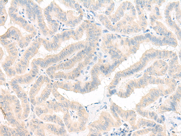 AOAH Antibody[46930]