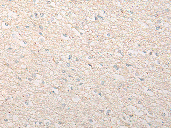 CCP110 Antibody[46945]