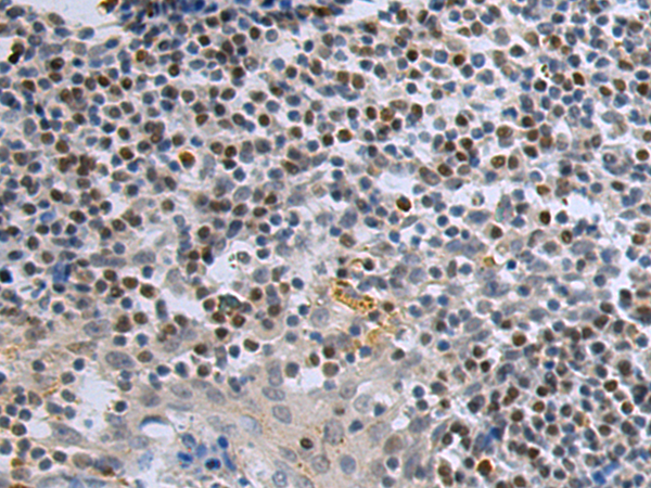 DCPS antibody[31840]