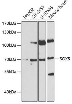 SOX5 Polyclonal Antibody[30782